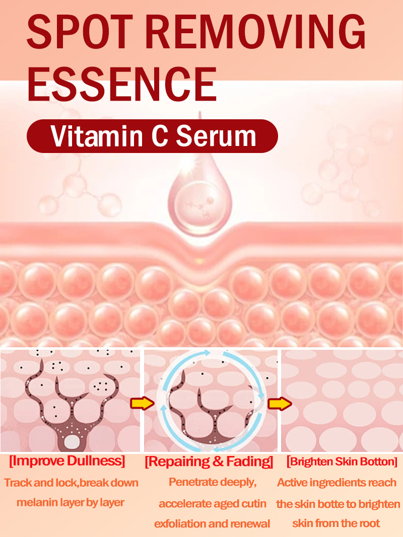 Lighten Freckles Melasma, Faci - Skincare Luxury Whitening review and price